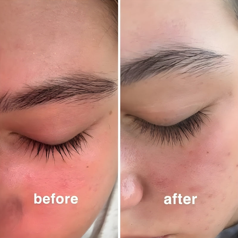 Eyelash Growth Serum